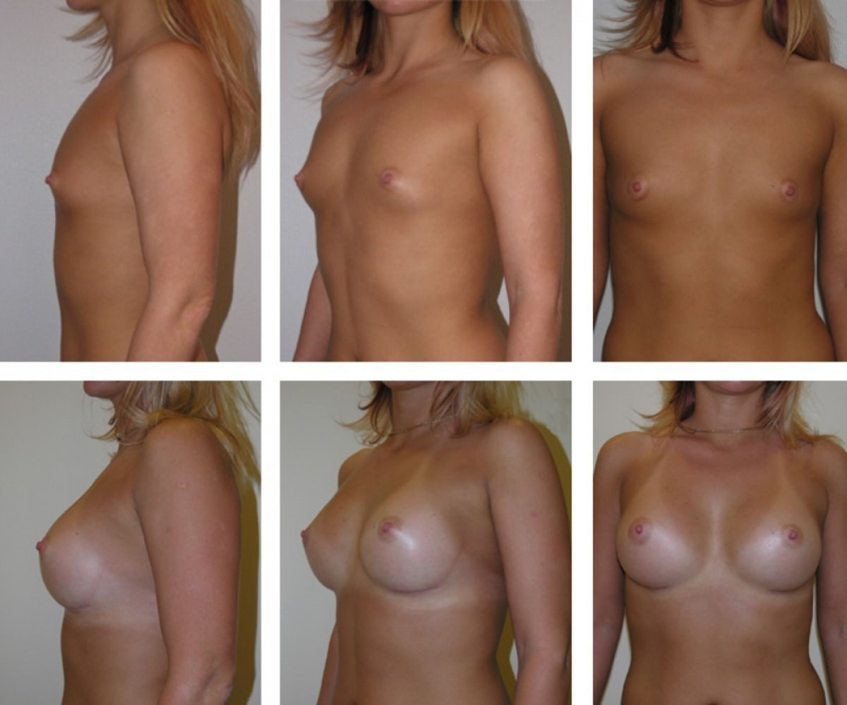 увеличилась одна грудь во время менструации фото 38