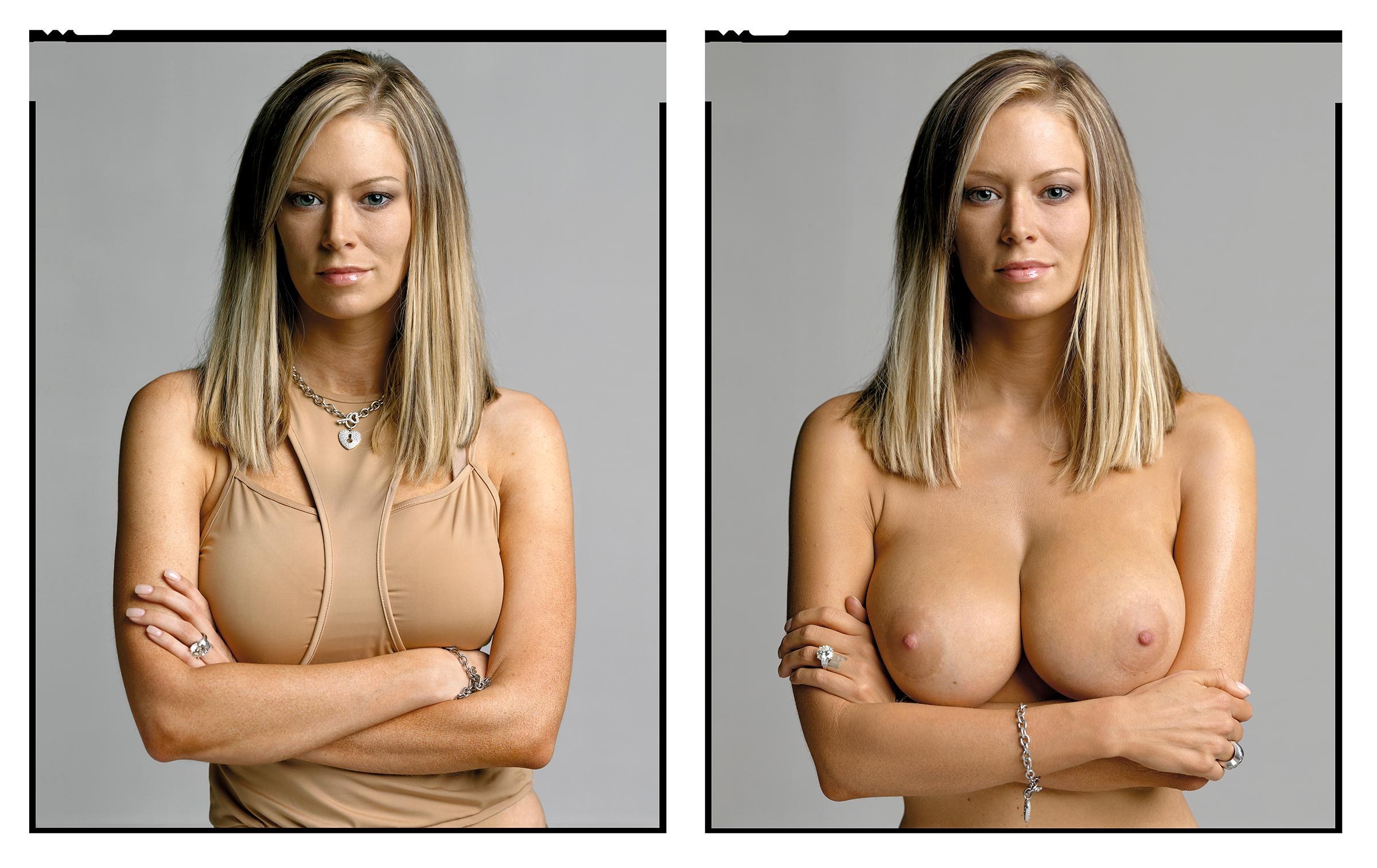 Pictures Of Women With Large Breasts