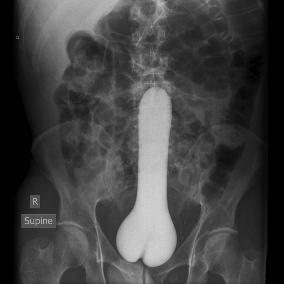 Порно как член входит во влагалище рентген