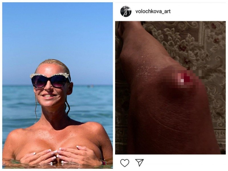 Анастасия Волочкова nude