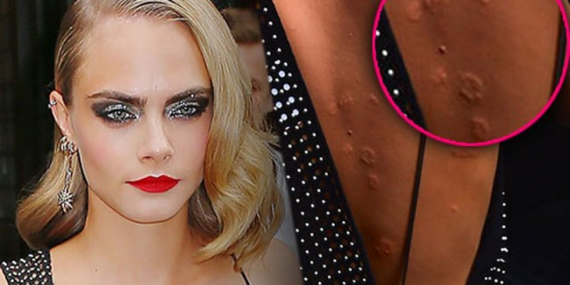 Cara Delevingne сливы