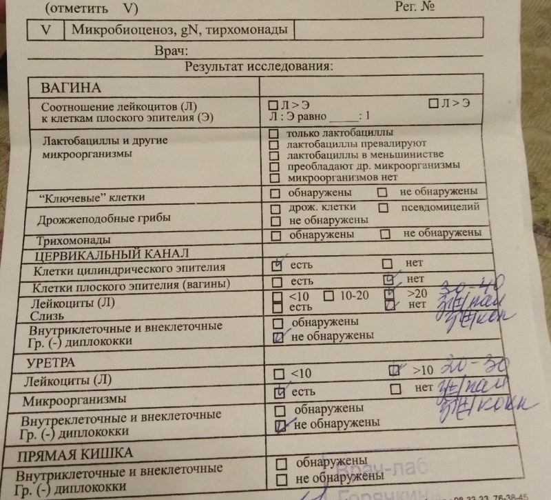 3d модель матки