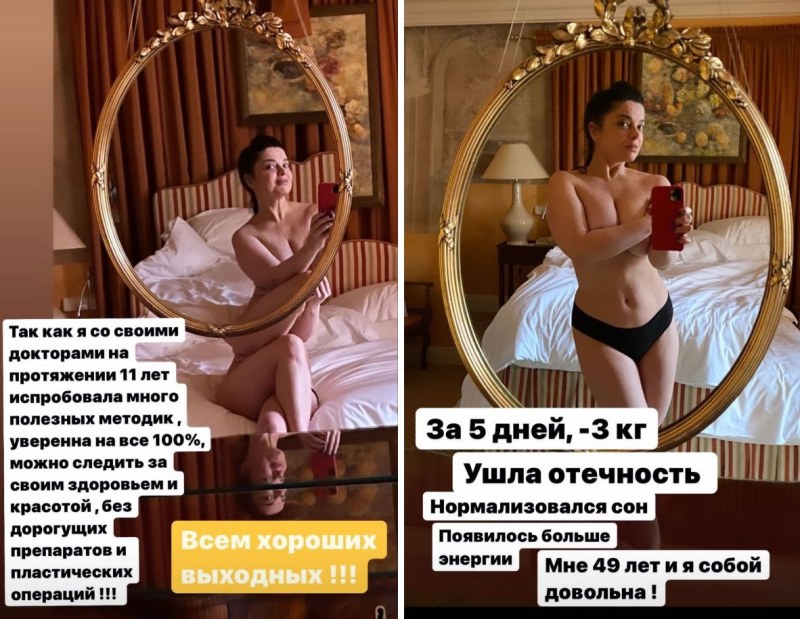 49-Летняя Наташа Королева снялась топлес